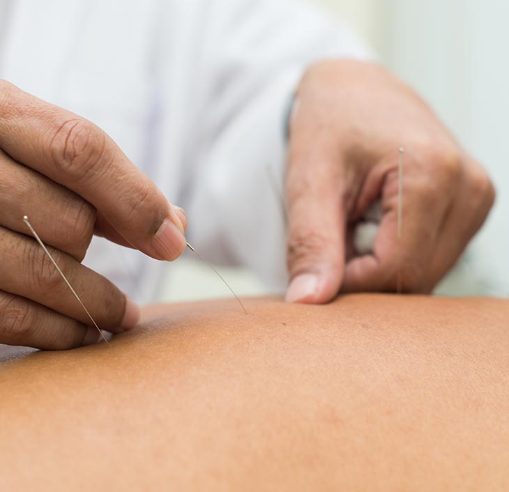 Acupuncture-Ramsgate Acupuncture-Ramsgate