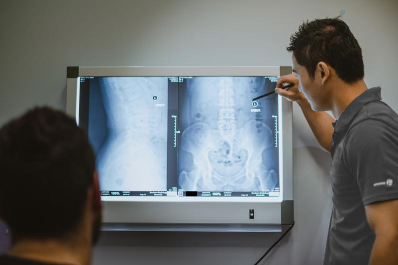 Chiropractic-X-rayimage Blakehurst-family-chiropractic-care