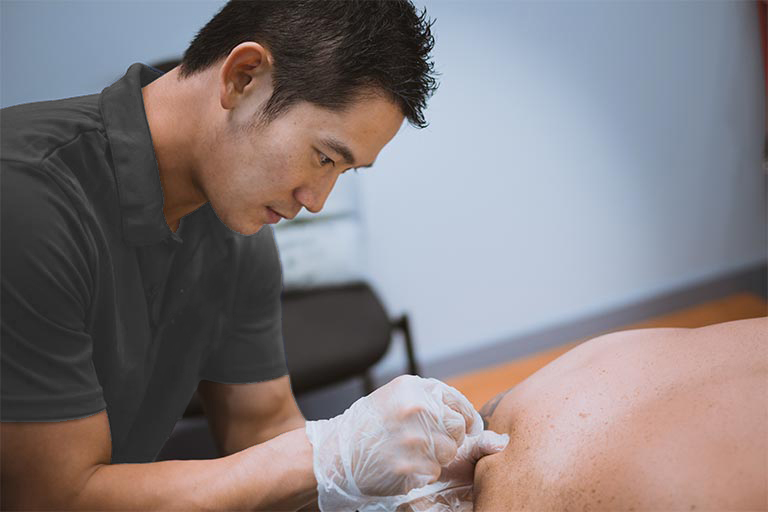 acupuncture-Bexley-1